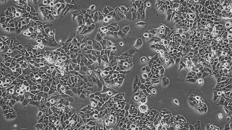 MHCC97-H人高轉(zhuǎn)移潛能肝癌細(xì)胞（STR鑒定正確）