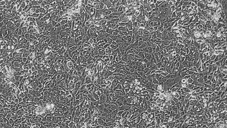 Calu-3人肺腺癌細胞（STR鑒定正確）