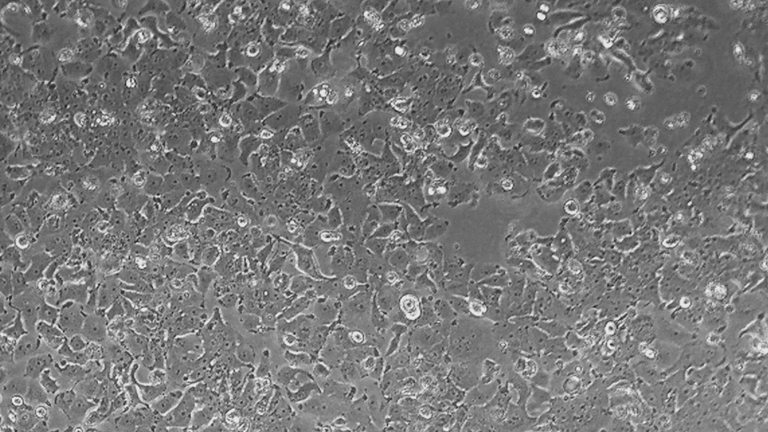 NCI-H2170人肺鱗癌細胞（STR鑒定正確）