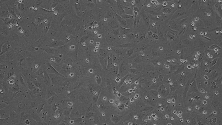 NCI-H196人小細(xì)胞肺癌細(xì)胞（胸腔積液）（STR鑒定正確）