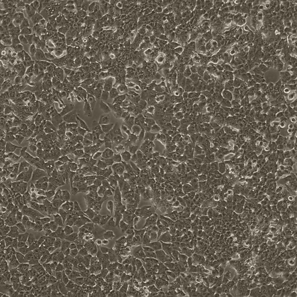 MHCC-LM3人高轉(zhuǎn)移潛能肝癌細(xì)胞（STR鑒定正確）