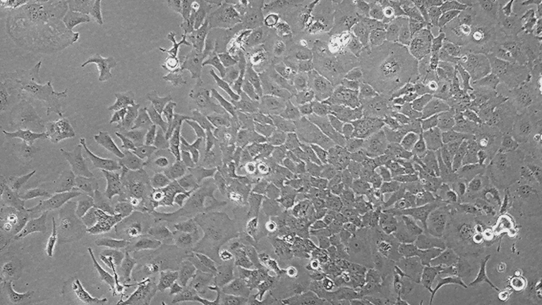Kyse-520人食管鱗癌細胞（STR鑒定正確）
