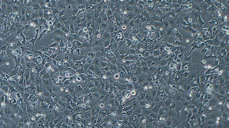 UM-SCC-1人口底鱗癌細胞（STR鑒定正確）