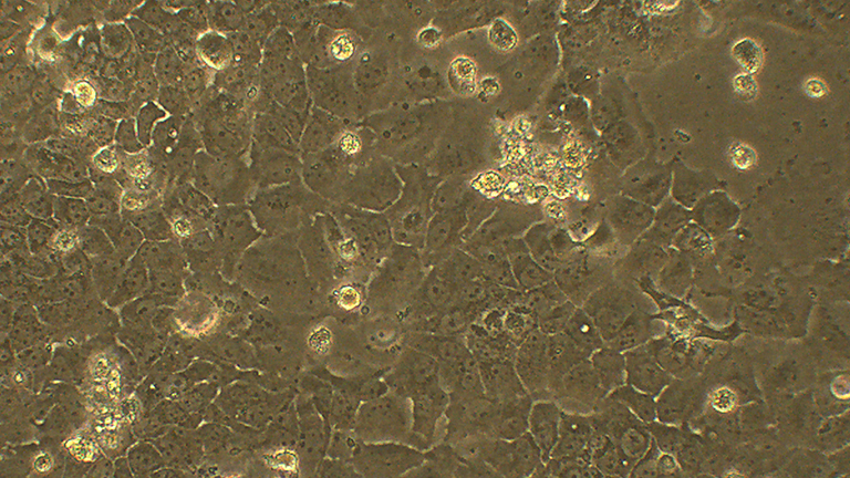 Caov-3人卵巢癌細胞（STR鑒定正確）