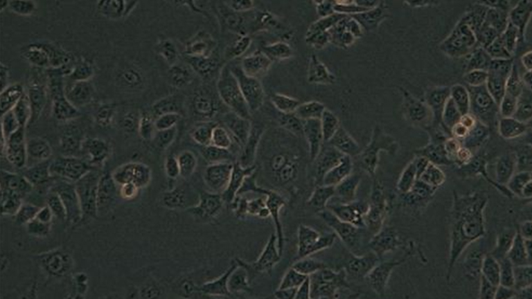 G-401人腎癌Wilms細(xì)胞（STR鑒定正確）