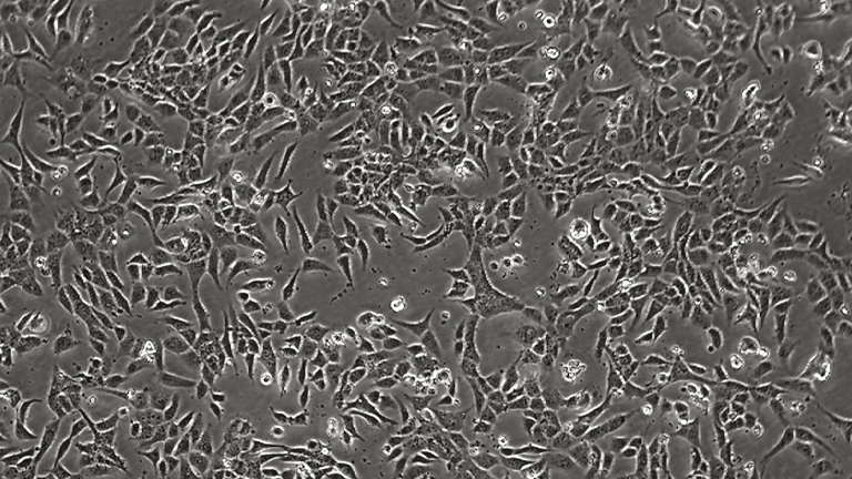 Het-1A人食管上皮細(xì)胞（STR鑒定正確）