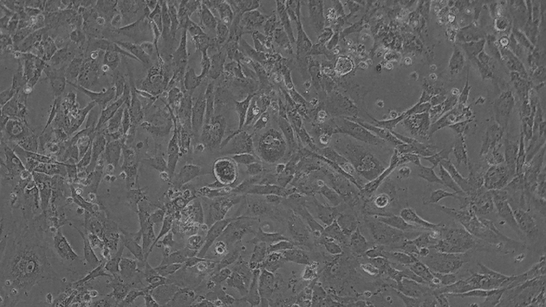 HTERT-HPNE人永生化胰腺導(dǎo)管細(xì)胞（STR鑒定正確）