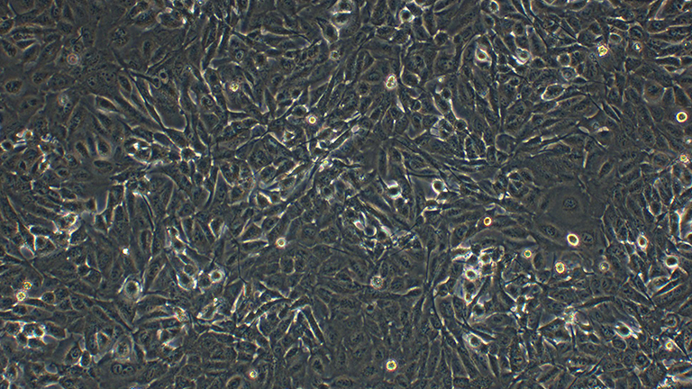 A-875人黑色素瘤細(xì)胞（STR鑒定正確）