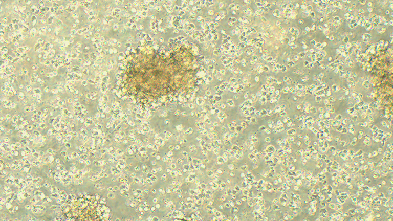 ARH-77人外周血淋巴瘤白血病細胞（STR鑒定正確）