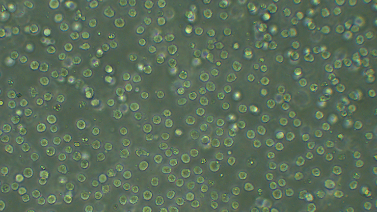 KU812人外周血嗜堿性白血病細胞（STR鑒定正確）