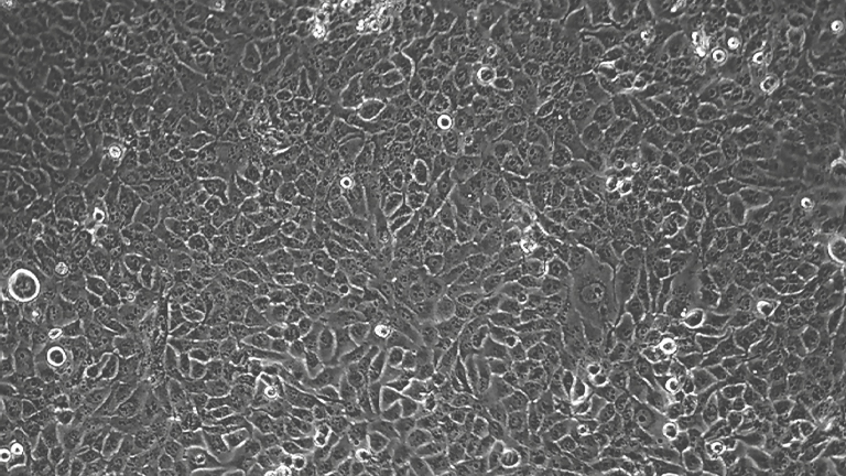 SACC-83人涎腺腺樣囊性癌細胞（STR鑒定正確）