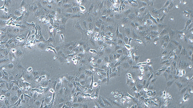 K1人甲狀腺癌細胞（乳頭狀）（STR鑒定正確）