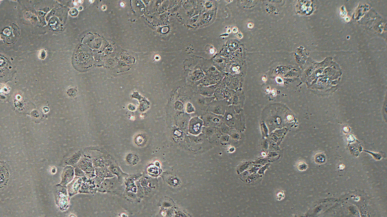 SW1990人胰腺癌細(xì)胞（二級(jí)腺癌）（STR鑒定正確）