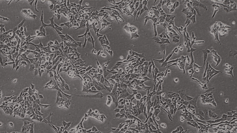 SK-N-MC人神經(jīng)上皮瘤細胞（STR鑒定正確）