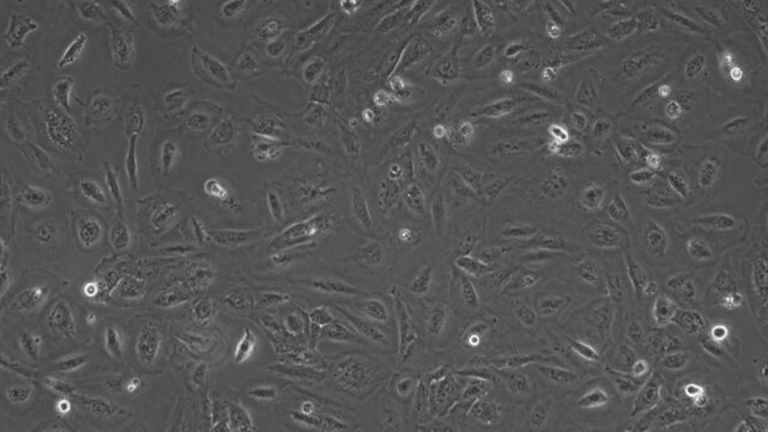 Daoy人髓母細胞瘤細胞（STR鑒定正確）