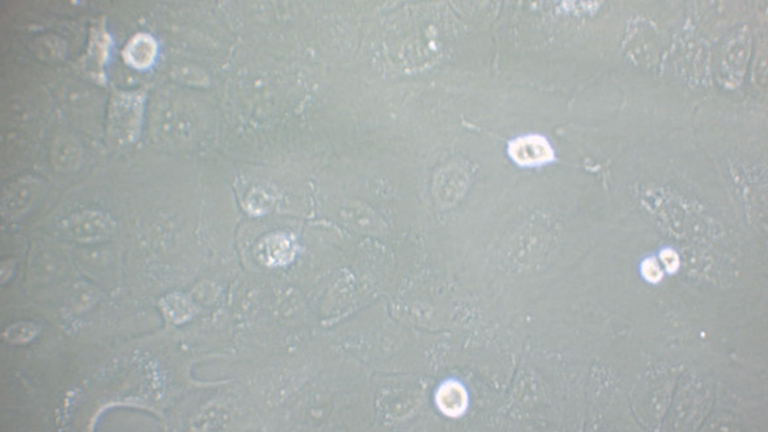 SCC-4人舌鱗癌細胞（STR鑒定正確）