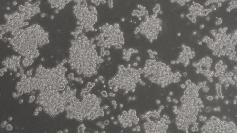 SK-NEP-1人尤因肉瘤細胞（STR鑒定正確）