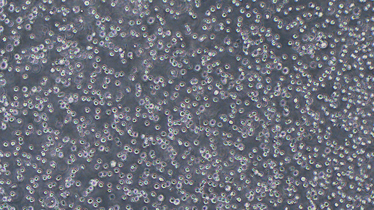 H22  BALB/c小鼠肝癌細(xì)胞（STR鑒定正確）