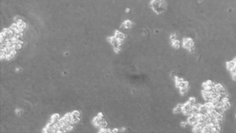 DMS 153人小細胞肺癌細胞（STR鑒定正確）