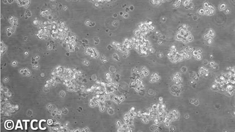 NCI-H69人小細胞肺癌細胞（STR鑒定正確）