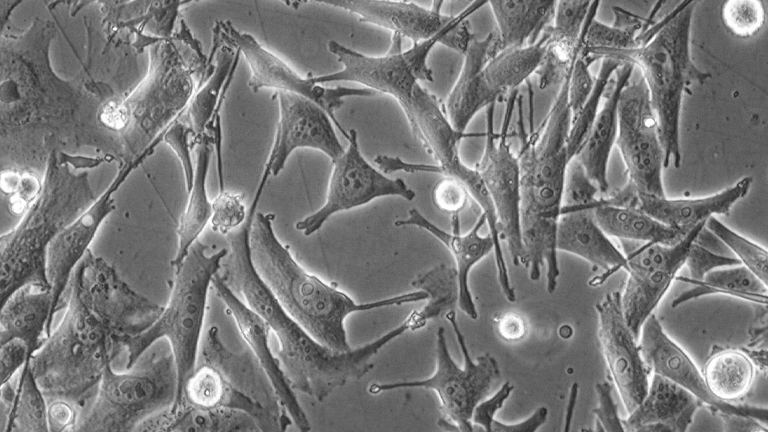 SK-MEL-2人皮膚黑色素瘤細(xì)胞（STR鑒定正確）