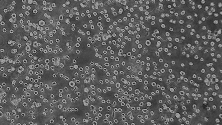 TF-1人血液白血病細胞（STR鑒定正確）