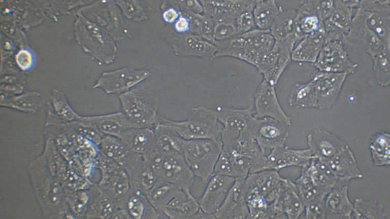 KMH-2人甲狀腺癌細胞（退行性）（STR鑒定正確）