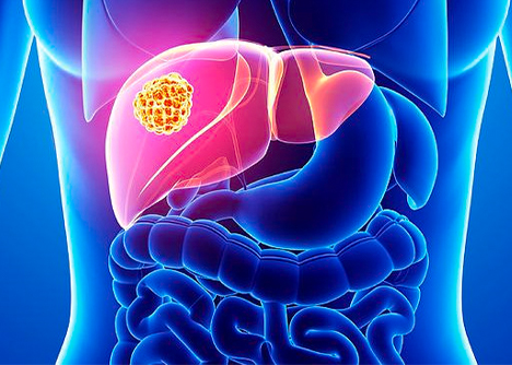 細(xì)胞學(xué)堂|人肝癌細(xì)胞系