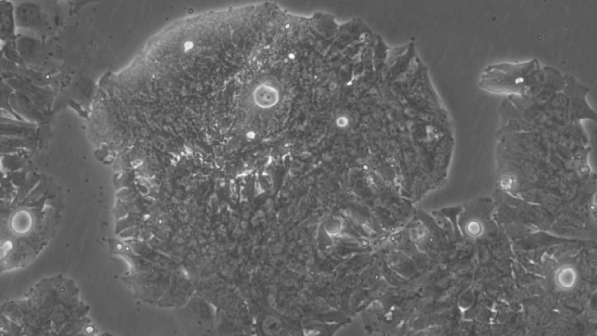 SW948人結(jié)腸腺癌細(xì)胞（STR鑒定正確）