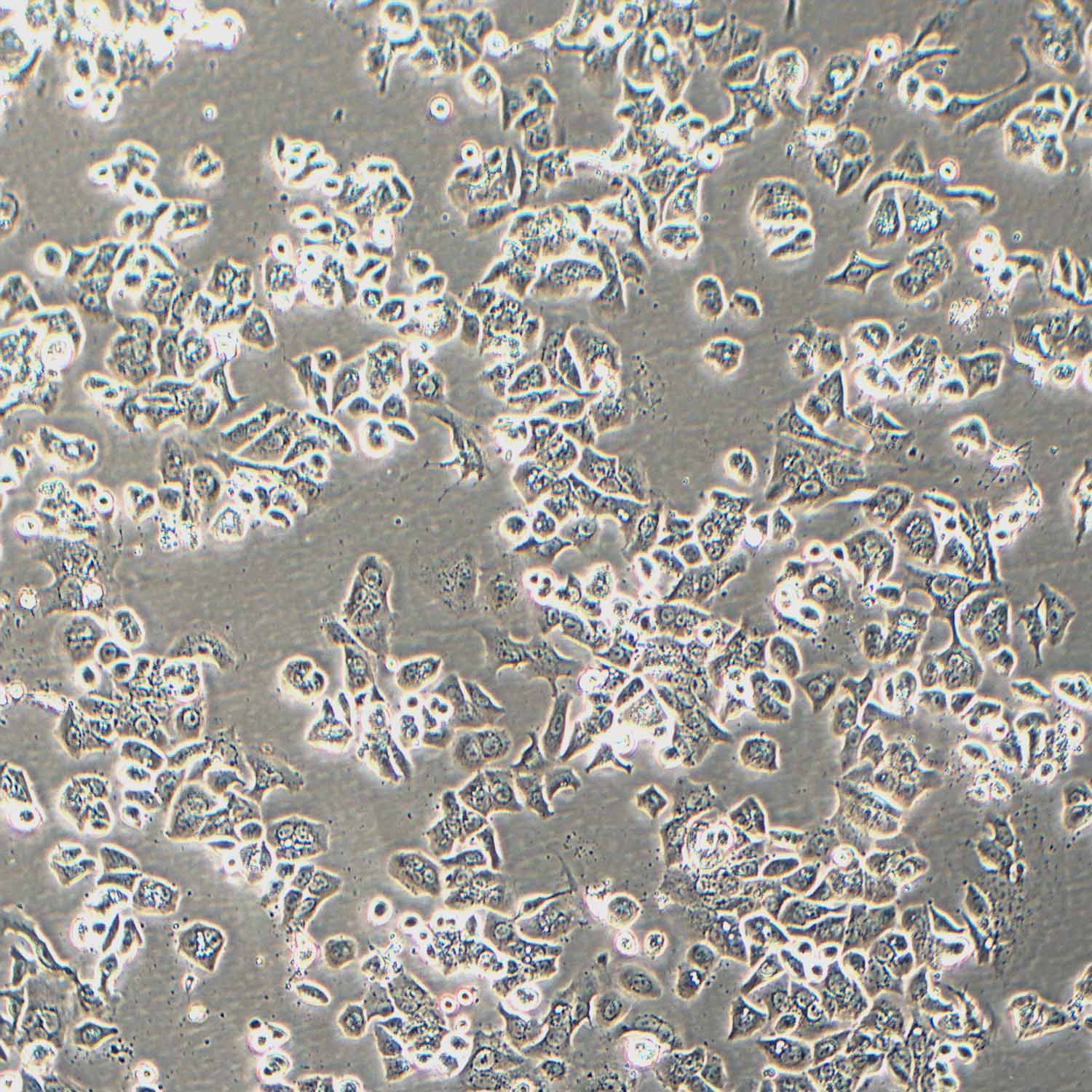 SK-BR-3-LUC示蹤穩(wěn)定細胞株（STR鑒定正確）