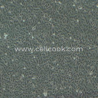 THLE-2人肝永生化細(xì)胞（STR鑒定正確）