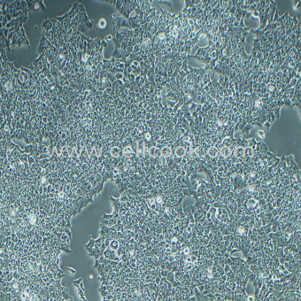 NCCIT ?畸胎癌細(xì)胞（STR鑒定正確）