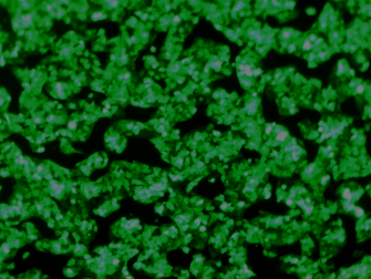 Hep G2-NTCP-GFP 過(guò)表達(dá)NTCP基因的帶GFP熒光的人肝癌細(xì)胞株（STR鑒定正確）