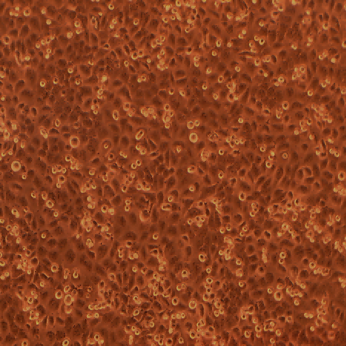 HNE-1人鼻咽癌細(xì)胞（STR鑒定正確）