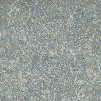 HCT-8人結(jié)直腸腺癌細(xì)胞（STR鑒定正確）