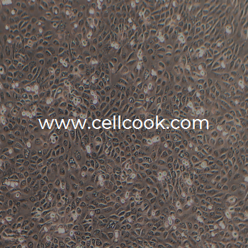 SCC-25人舌鱗癌細(xì)胞（STR鑒定正確）