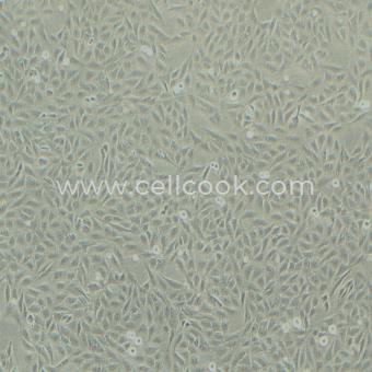 U-2 OS人骨肉瘤細胞（STR鑒定正確）