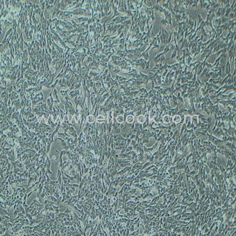 SH-SY5Y人神經(jīng)母細胞瘤細胞（STR鑒定正確）