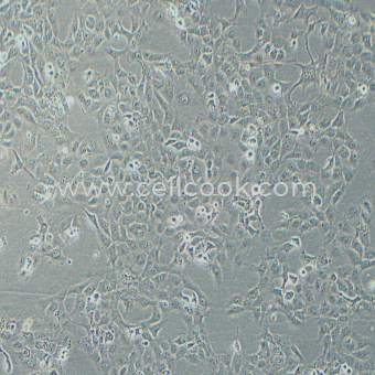 B-CPAP人甲狀腺癌細胞（乳頭狀）（STR鑒定正確）