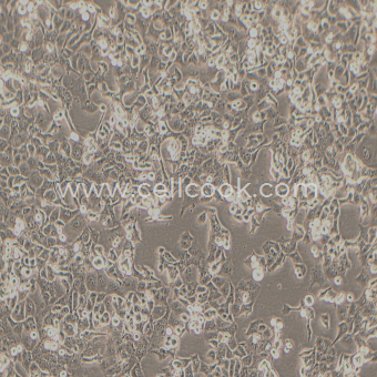 Panc-1人胰腺癌細胞（未分化）（STR鑒定正確）