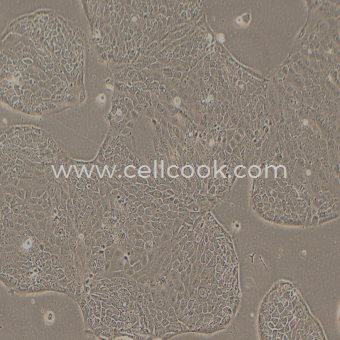 Capan-2人胰腺癌細(xì)胞（高分化）（STR鑒定正確）