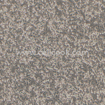 AsPC-1人轉(zhuǎn)移胰腺腺癌細(xì)胞(中等至未分化)（STR鑒定正確）