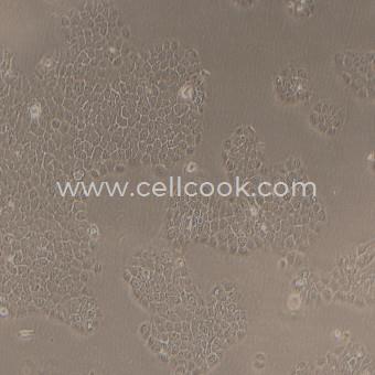 Bxpc-3人原位胰腺癌細(xì)胞（中等至未分化）（STR鑒定正確）