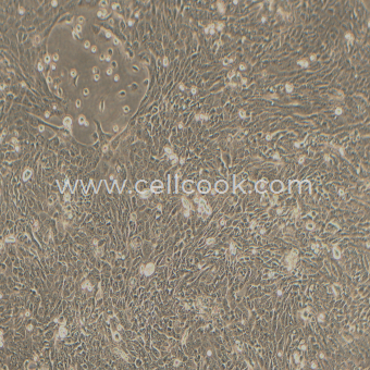 CFPAC-1人胰腺癌細(xì)胞（STR鑒定正確）