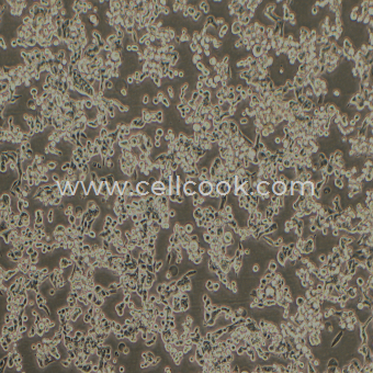 SUIT-2人胰腺癌細(xì)胞（STR鑒定正確）