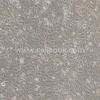 NCI-H28人間皮瘤細(xì)胞（STR鑒定正確）