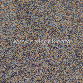 293T SV40T轉(zhuǎn)化的人胚腎細(xì)胞（STR鑒定正確）