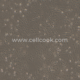 HUVEC-T1人臍靜脈內(nèi)皮細(xì)胞（STR鑒定正確）