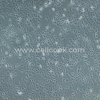 RWPE-1人正常前列腺上皮細(xì)胞（STR鑒定正確）