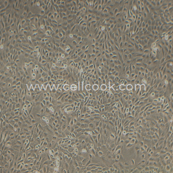 MCF-10A人正常乳腺上皮細(xì)胞（STR鑒定正確）